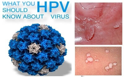 Sử dụng bao cao su có bị lây virus HPV không?